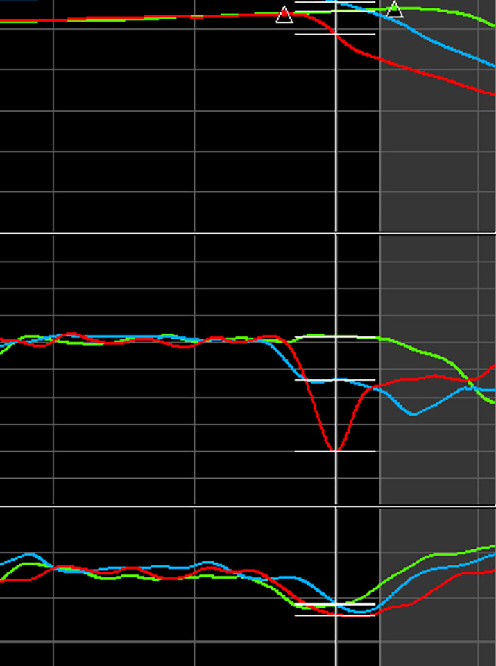 The middle plot of this AiM data graph, longitudinal g’s show the red line dips steeply and rises sharply, indicating two things when compared with the green and blue lines: over-slowing and a sudden release of the brake pedal. It is better to release the brake gradually approaching and through the turn-in point.